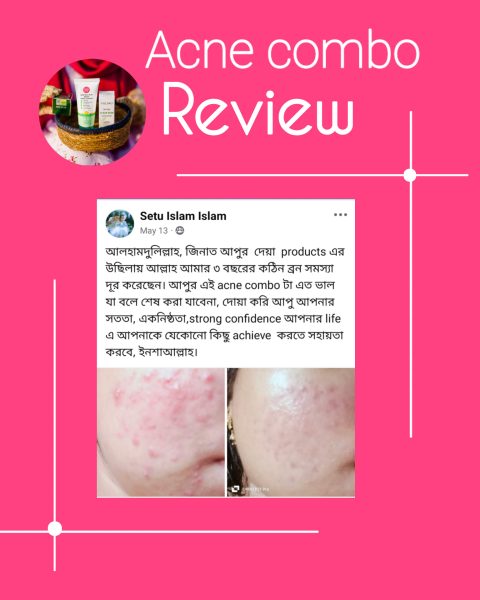 jinat care acne combo customer review (12)