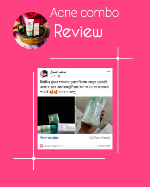 jinat care acne combo customer review (23)