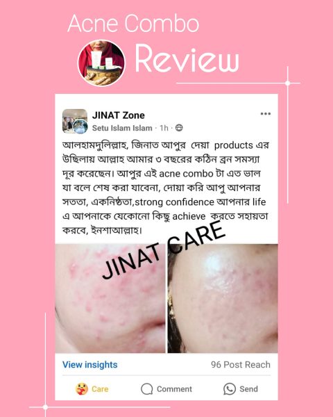 jinat care acne combo customer review (4)